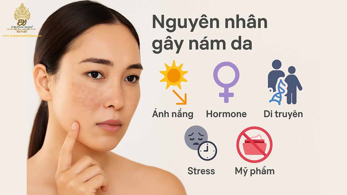 cach cham soc da nam tot nhat