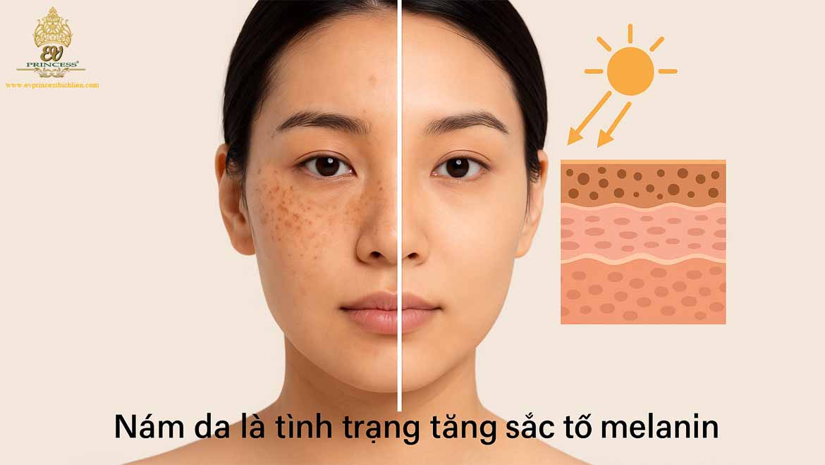 nam da va cach dung kem tri nam