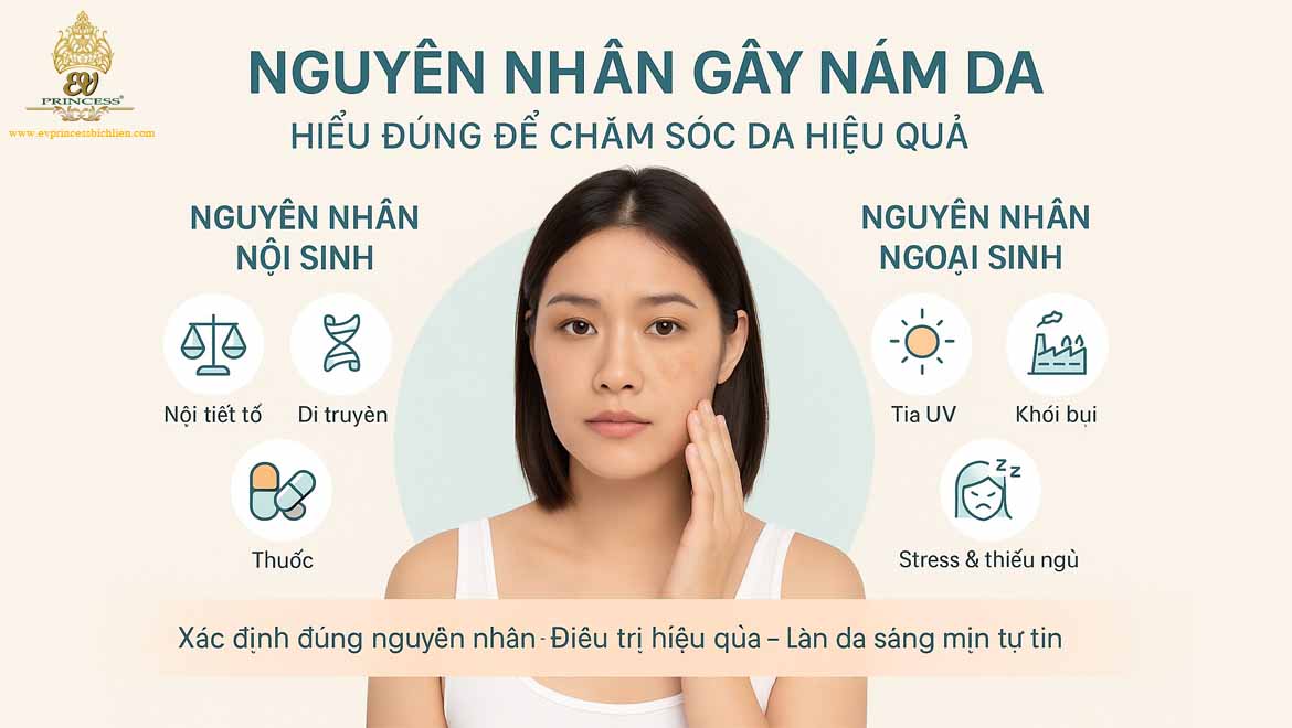 nguyen nhan gay nam da