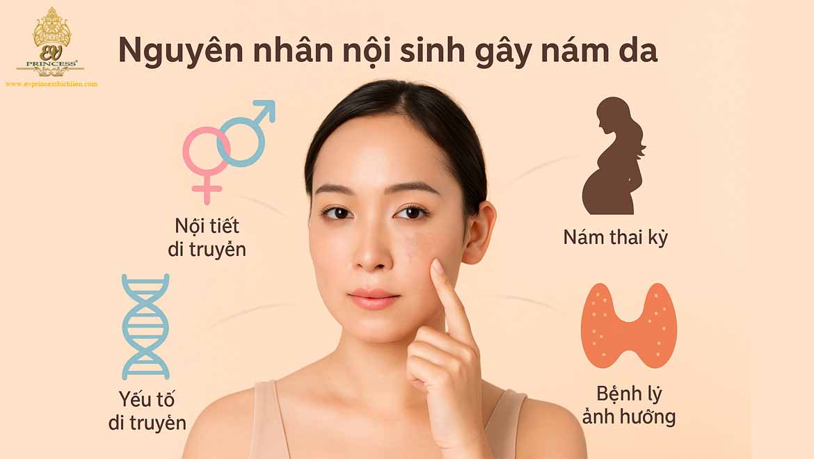 nguyen nhan gay nam da