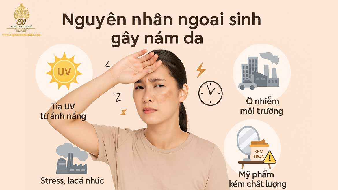 nguyen nhan gay nam da