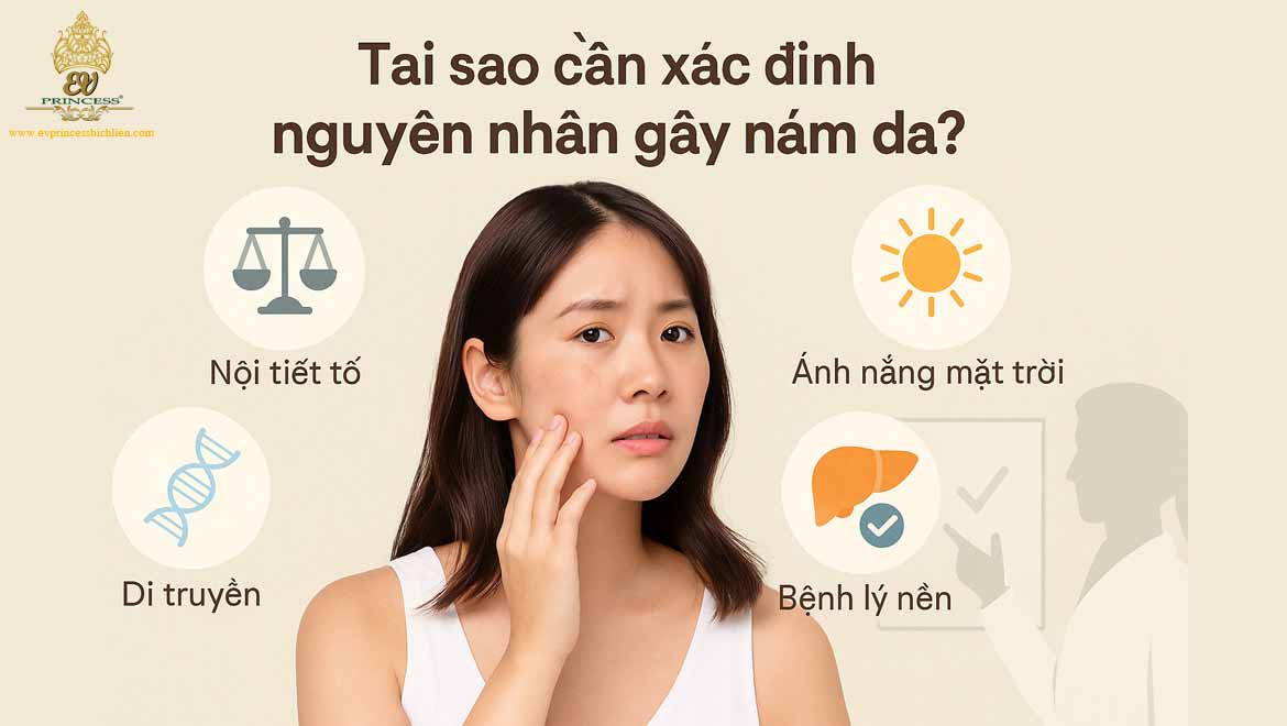 nguyen nhan gay nam da