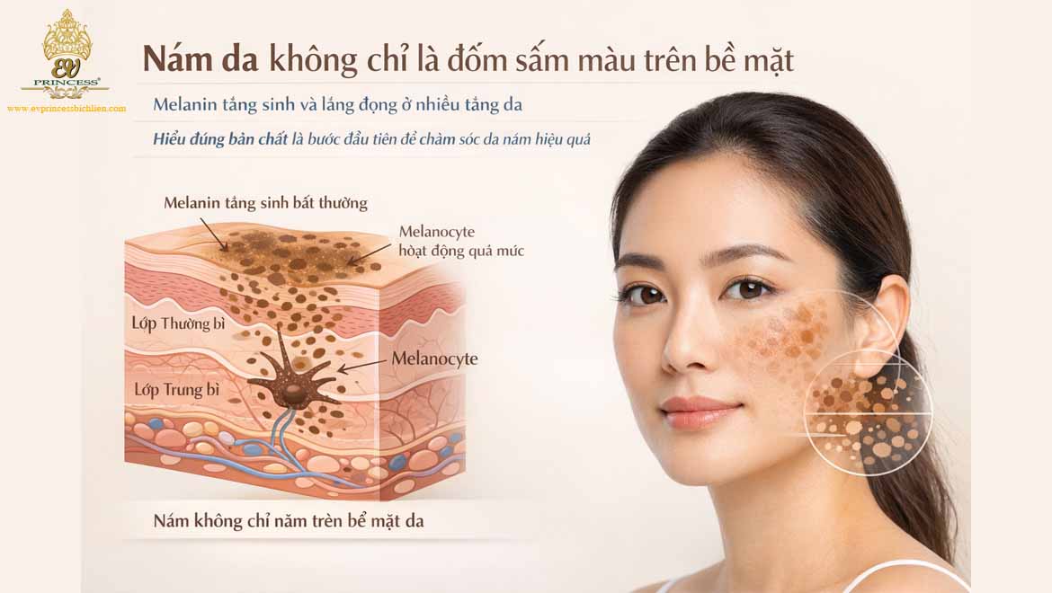 bi quyet cham soc da mat bi nam