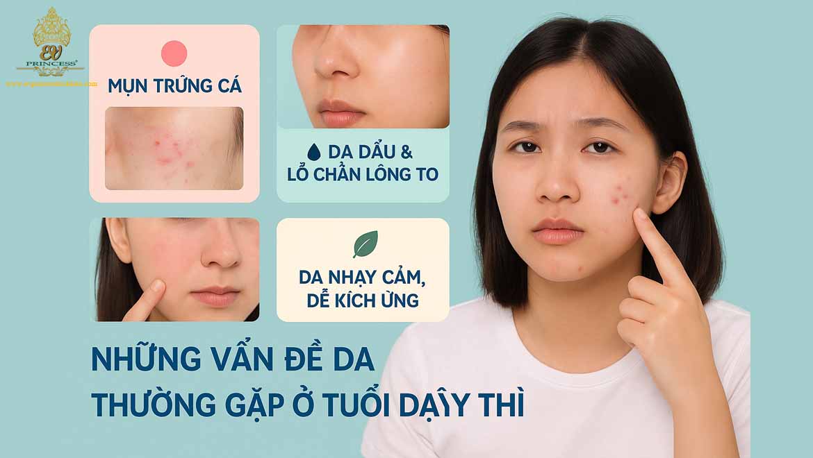 cham soc da mat o tuoi day thi