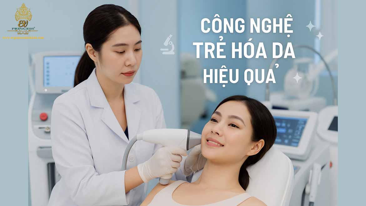 lao hoa da la gi
