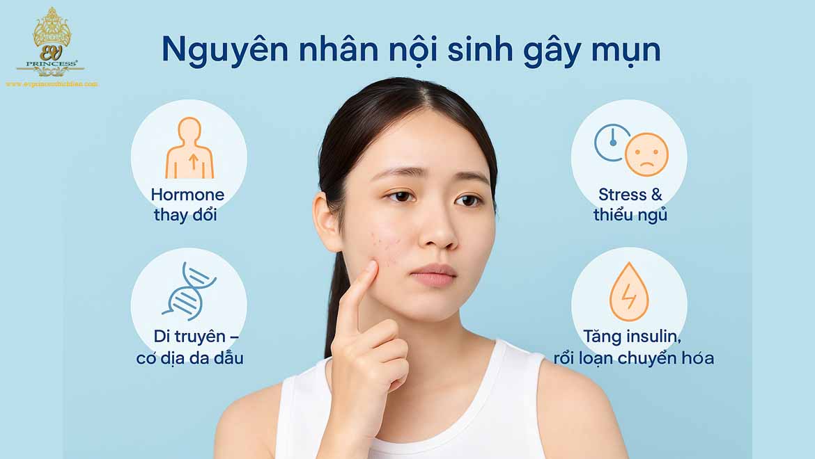 nguyen nhan chu yeu gay ra mun