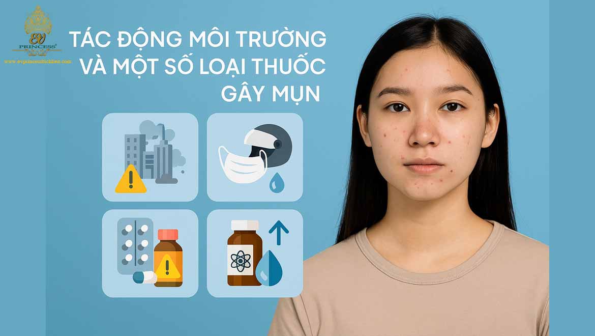 nguyen nhan noi mun o tuoi day thi