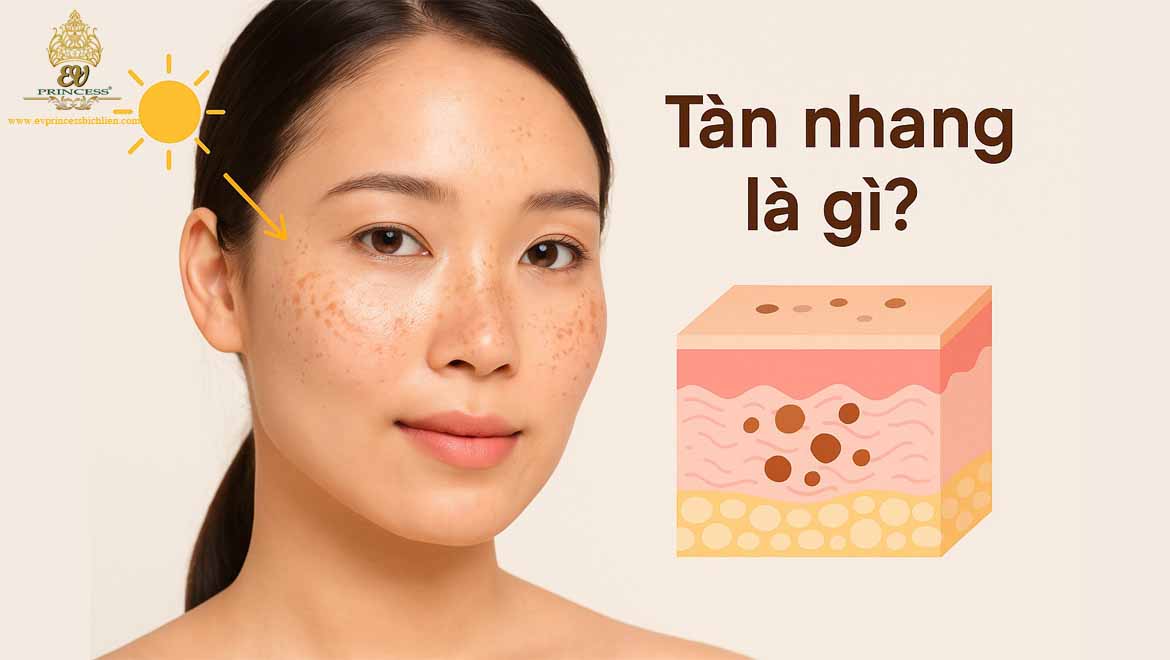 nguyen nhan gay tan nhang