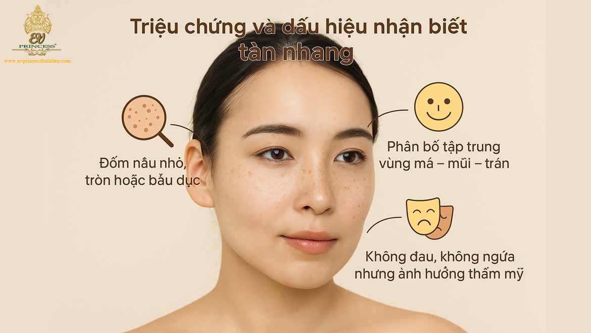 nguyen nhan gay tan nhang
