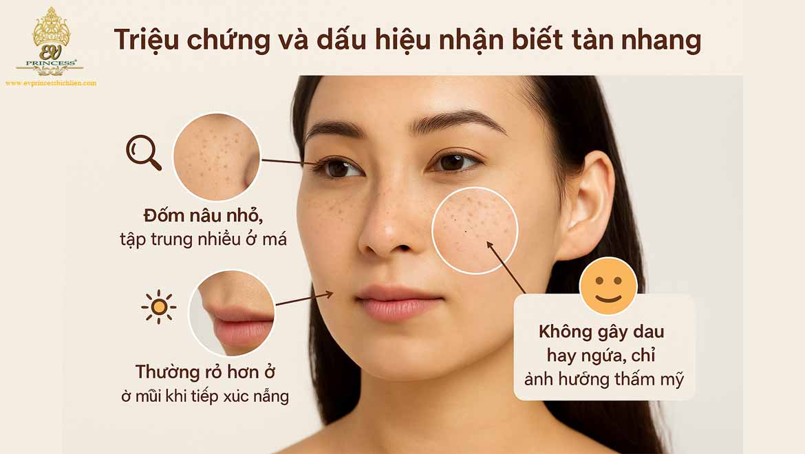 nguyen nhan gay tan nhang