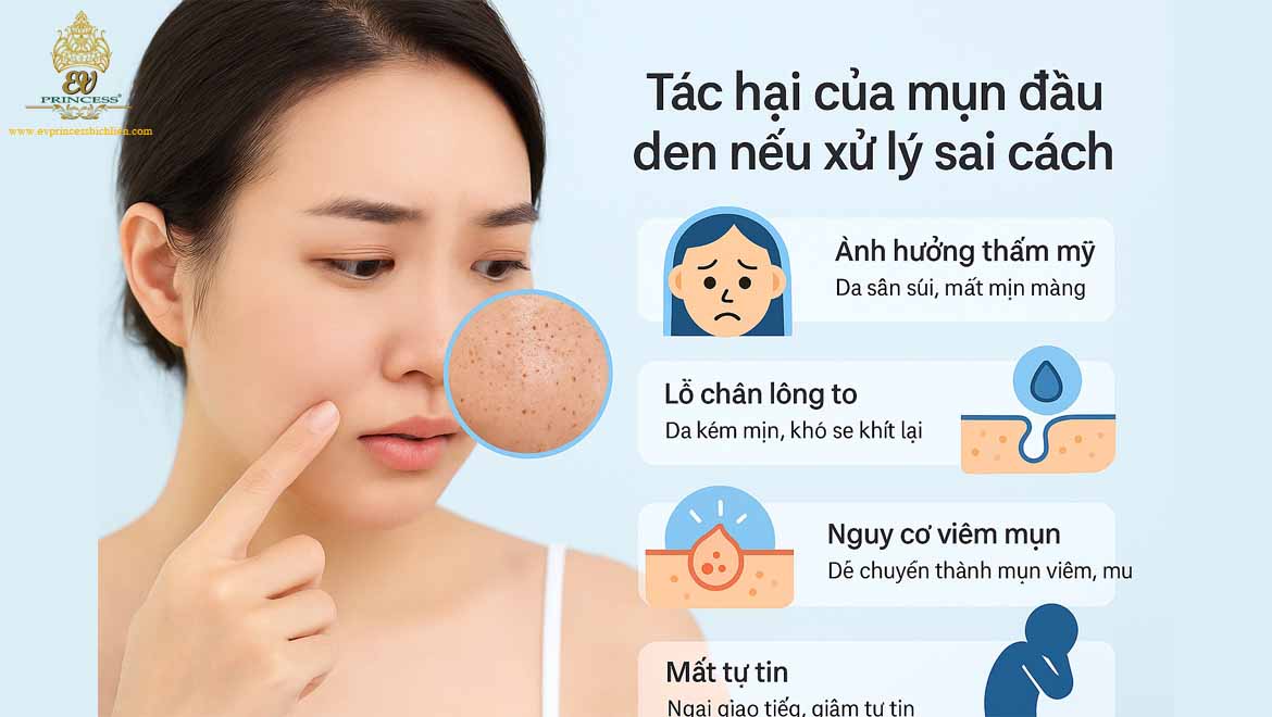 mun dau den la gi