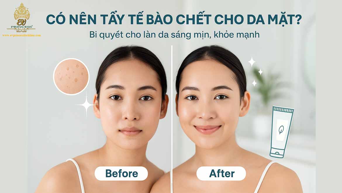 co nen tay te bao chet cho da mat