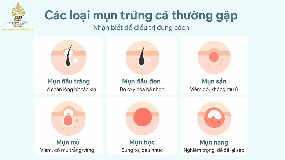 mun trung ca la gi