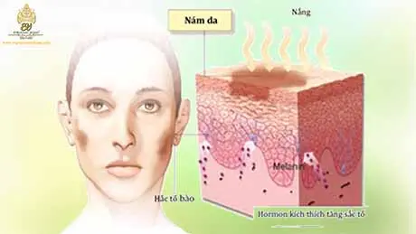 nam da la gi