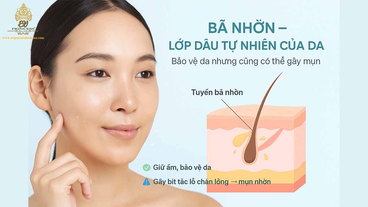 tai sao da mat bi mun nhon