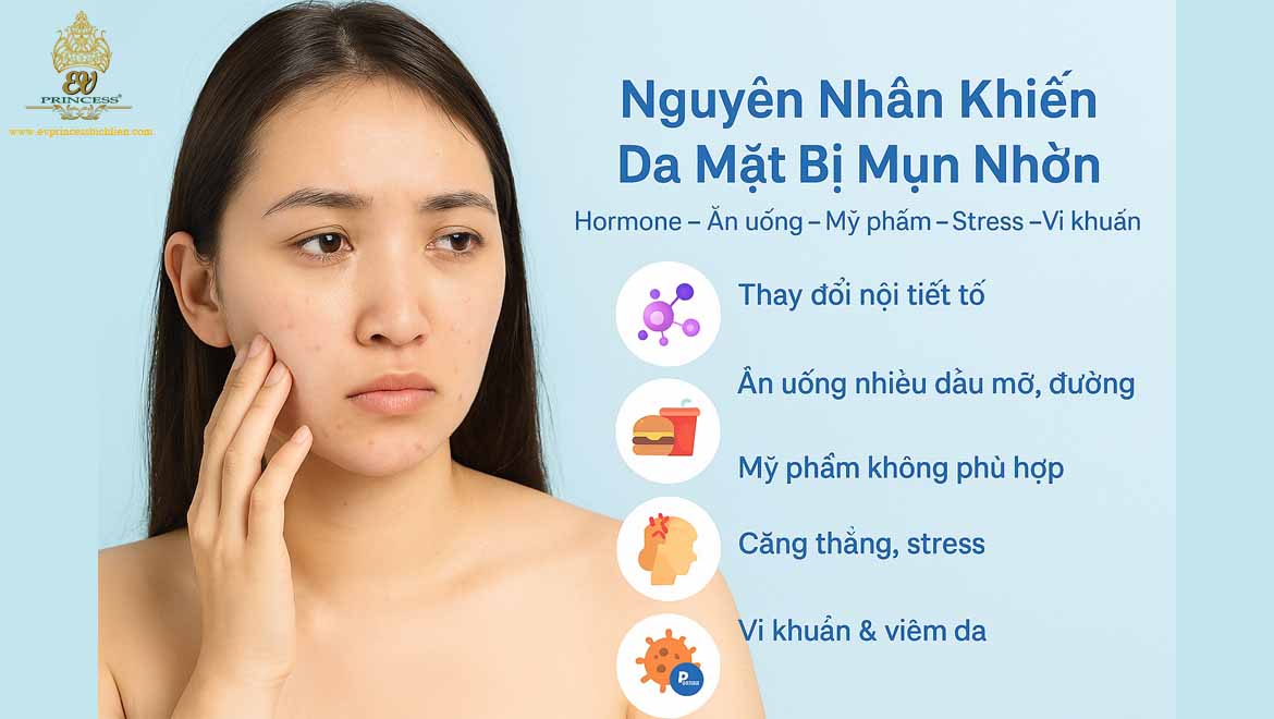 tai sao da mat bi mun nhon
