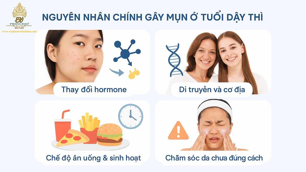 cach khong bi noi mun o tuoi day thi