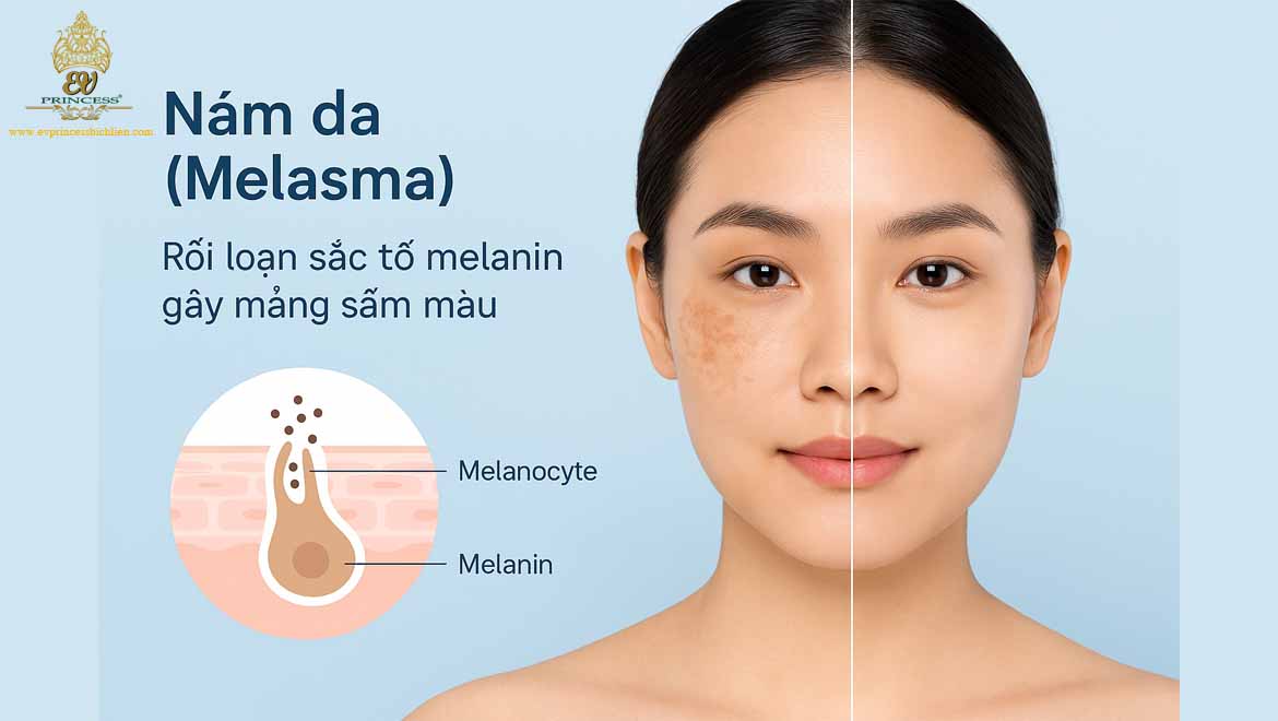 nam da co tri khoi hoan toan duoc khong