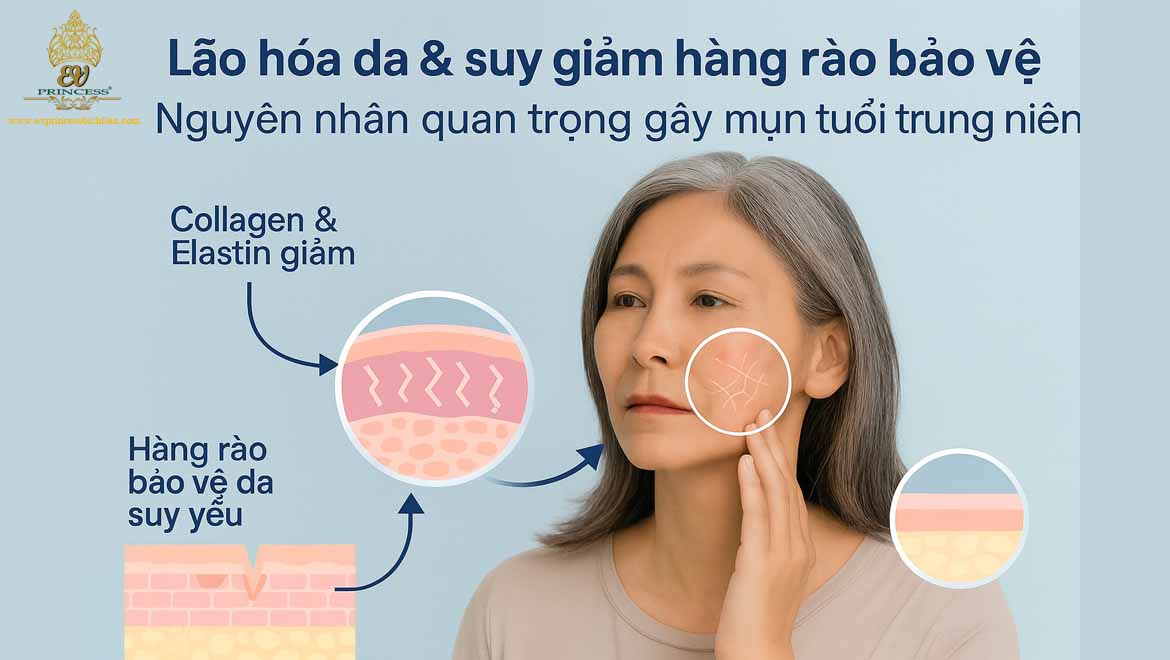 nguyen nhan khien da mat noi mun o tuoi trung nien