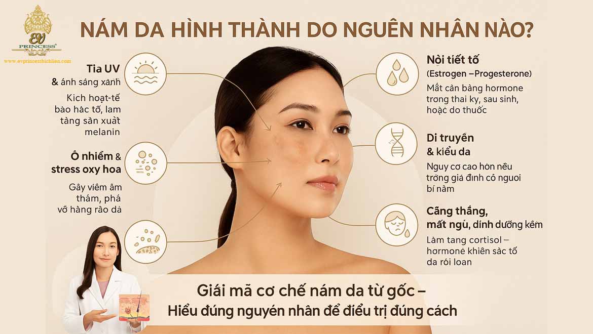 nam da hinh thanh do nguyen nhan nao