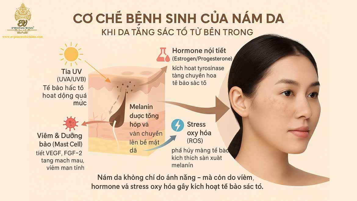 nam da hinh thanh do nguyen nhan nao