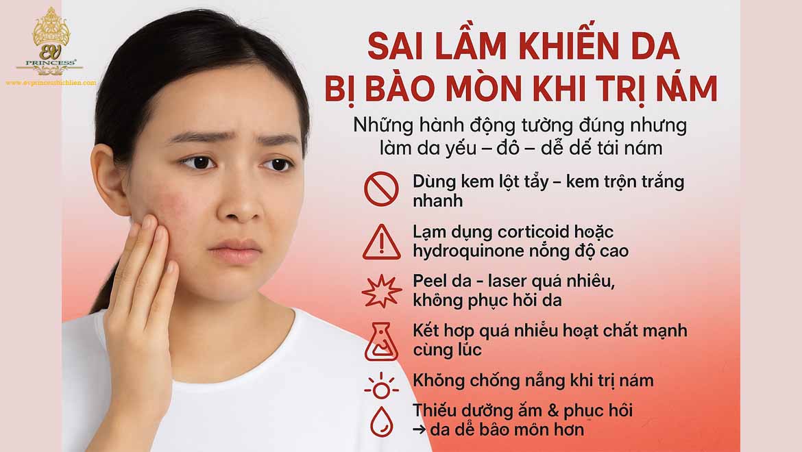 kem tri nam an toan khong bao mon