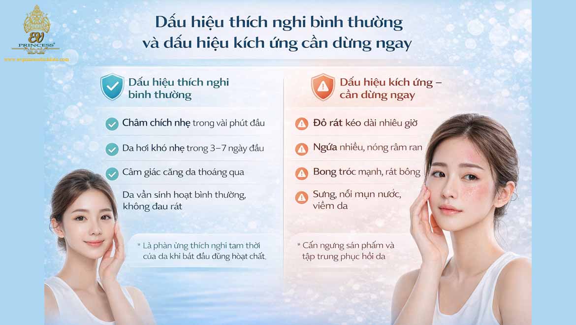 kem tri nam khong gay kich ung