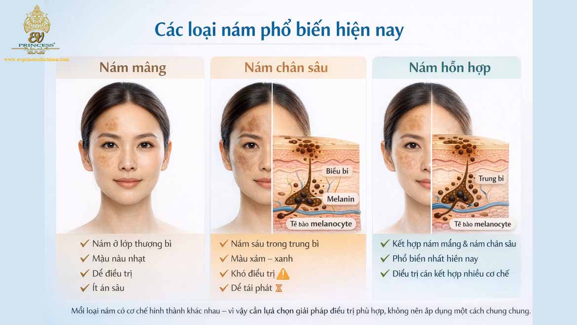 kem tri nam tot nhat hien nay