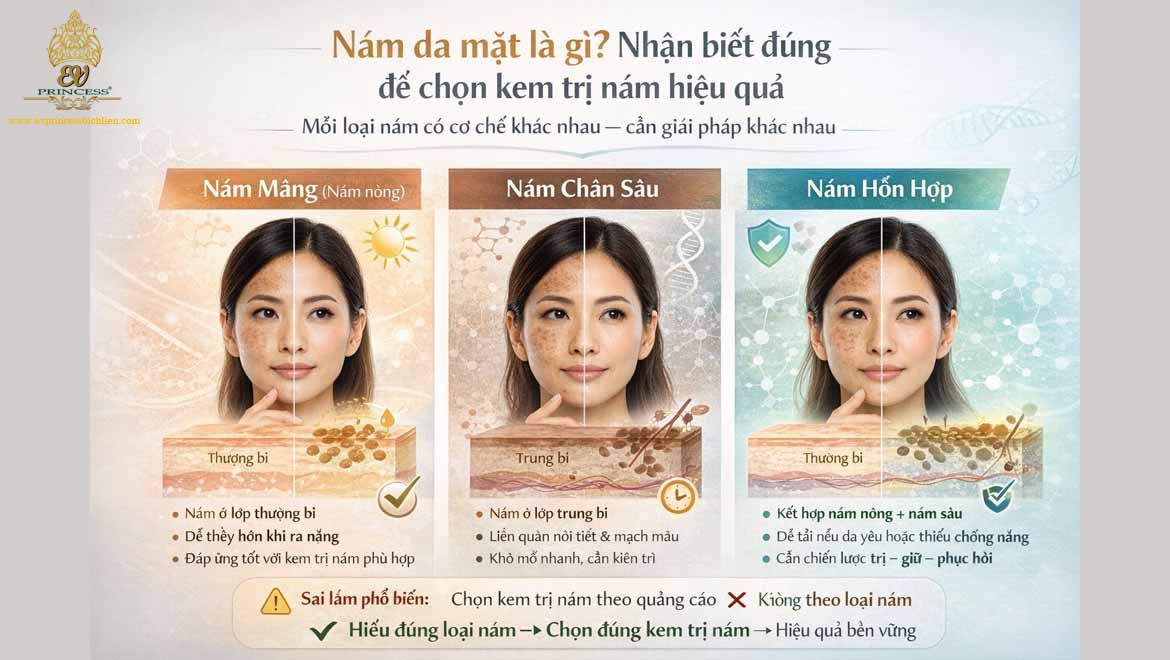 kem tri nam da mat hieu qua nhat